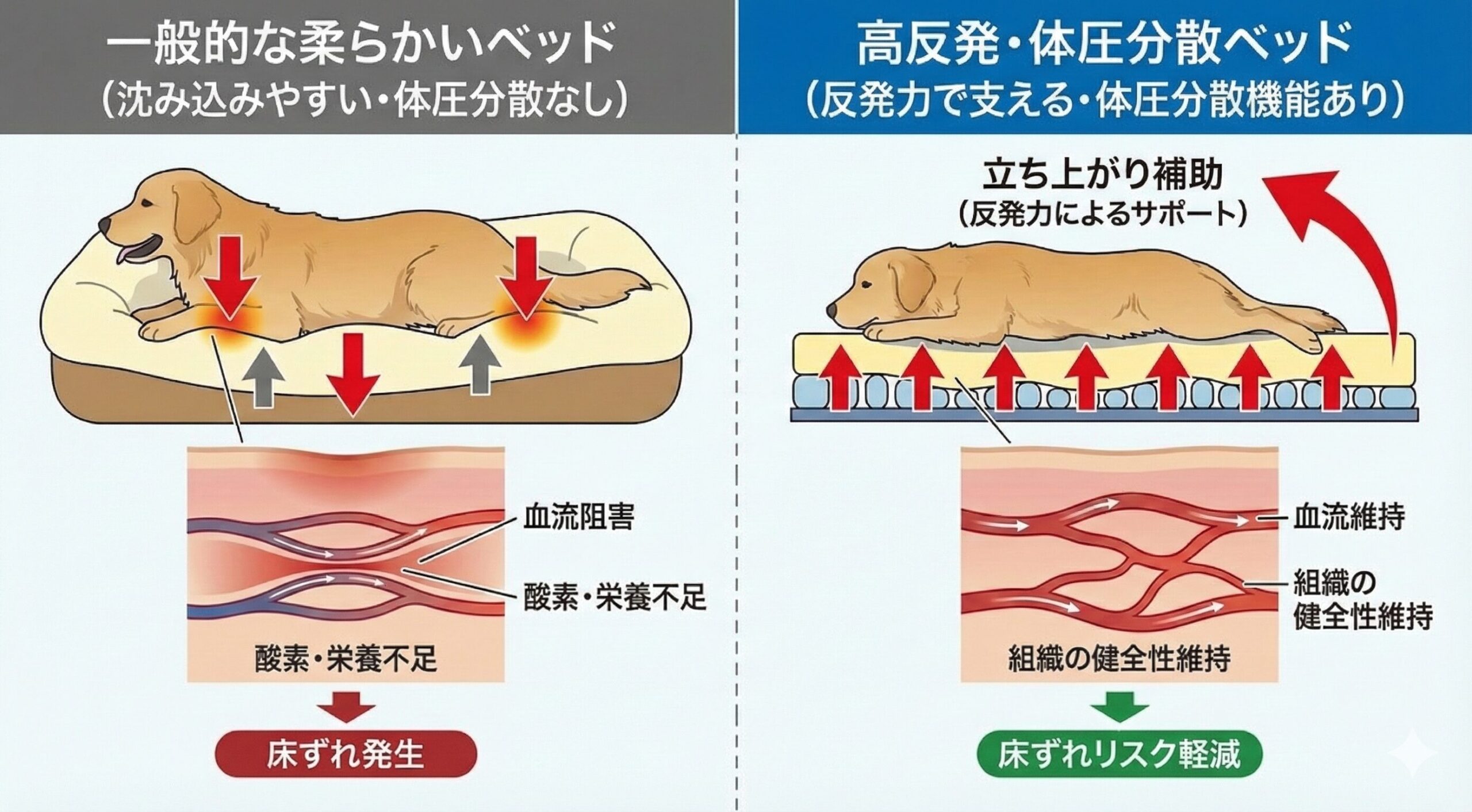 体圧分散機能により床ずれリスクが軽減される仕組みを示す図解